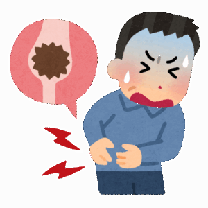 【疑問】尿路結石って女の子でもなるの？